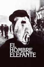 Imagen de El hombre elefante - 1