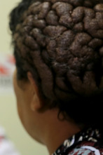 Imagen de Diagnósticos... (T3): El tumor en la cara de una diosa - 1